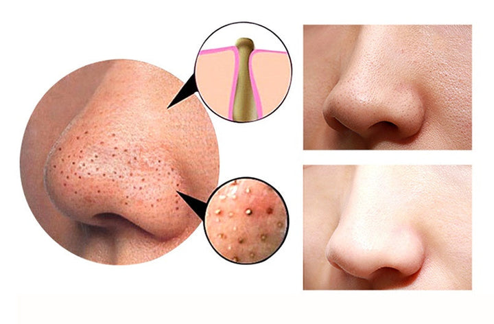 Revitalize Your Skin with the 4-in-1 Body Gua Sha and Cupping Machine