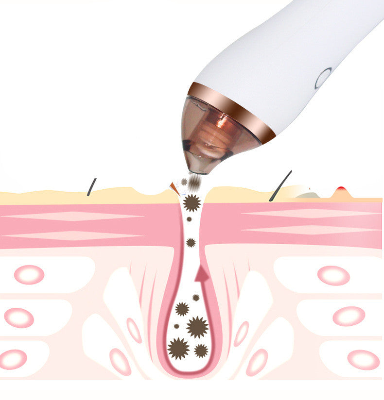 4-in-1 Body Guasha and Cupping Machine for Deep Facial Cleansing